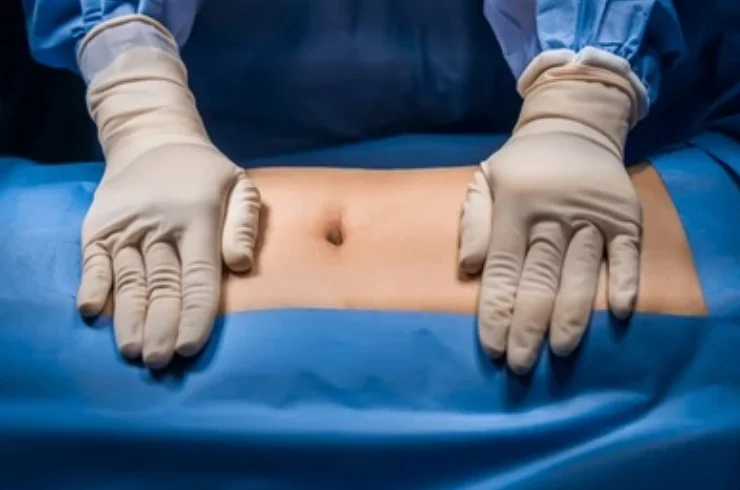Emergency Hernia Surgery
