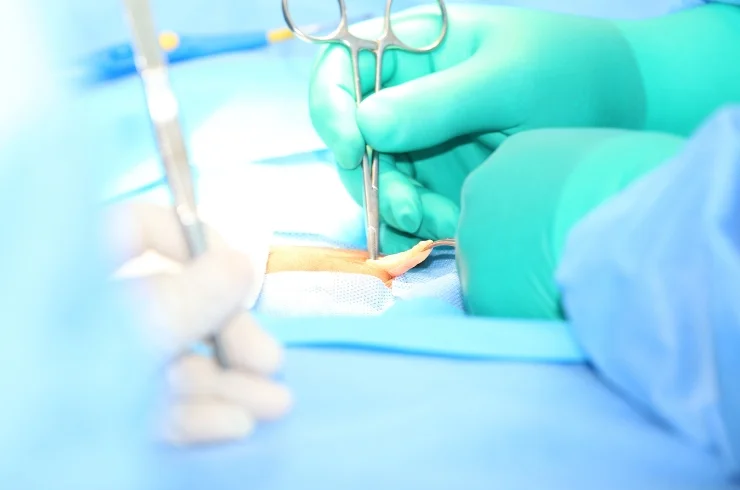 Open Hernia Repair Surgery
